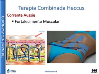 TREINAMENTOAVANÇADO
P&D Ibramed
Terapia Combinada Heccus
Corrente Aussie
 Fortalecimento Muscular
 