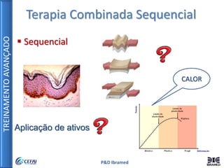 TREINAMENTOAVANÇADO
P&D Ibramed
Terapia Combinada Sequencial
 Sequencial
Aplicação de ativos
CALOR
 