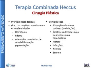 TREINAMENTOAVANÇADO
P&D Ibramed
Terapia Combinada Heccus
Cirurgia Plástica
 Promove lesão tecidual
 Grau das reações - acordo com a
extensão da lesão
 Hematoma
 Edema
 Alterações transitórias de
sensibilidade e/ou
pigmentação
 Complicações
 Alterações de relevo
cutâneo (ondulações)
 Cicatrizes aderentes e/ou
deprimidas e/ou
hipertróficas
 Fibrose
 Infecções
 Necrose
 Seroma
 