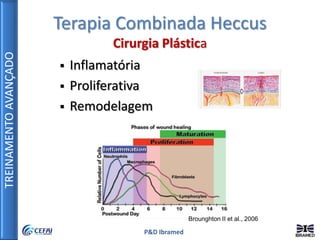 TREINAMENTOAVANÇADO
P&D Ibramed
 Inflamatória
 Proliferativa
 Remodelagem
Brounghton II et al., 2006
Terapia Combinada Heccus
Cirurgia Plástica
 