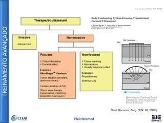 TREINAMENTOAVANÇADO
P&D Ibramed
Plast. Reconstr. Surg. (124: 92, 2009.)
 