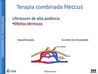 TREINAMENTOAVANÇADO
P&D Ibramed
Terapia combinada Heccus
Ultrassom de alta potência
Efeitos térmicos
Vasodilatação Aumento da viscosidade
 