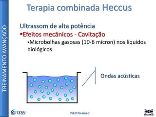 TREINAMENTOAVANÇADO
P&D Ibramed
Terapia combinada Heccus
Ultrassom de alta potência
Efeitos mecânicos - Cavitação
Microbolhas gasosas (10-6 mícron) nos líquidos
biológicos
Ondas acústicas
 