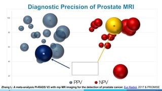 86
60
97
88
76 77
43
68
79
96
62
54
75
80
84
90
93
63
73
62
74
77
83
26
92
88
84
91
89
20
40
60
80
100
PPV NPV
Zhang L: A meta-analysis PI-RADS V2 with mp MR imaging for the detection of prostate cancer. Eur Radiol. 2017 & PROMISE
 