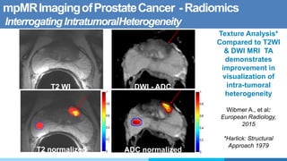 mpMRImagingofProstateCancer -Radiomics
InterrogatingIntratumoralHeterogeneity
Texture Analysis*
Compared to T2WI
& DWI MRI TA
demonstrates
improvement in
visualization of
intra-tumoral
heterogeneity
Wibmer A., et al:
European Radiology,
2015
*Harlick: Structural
Approach 1979
ADC normalizedT2 normalized
T2 WI DWI - ADC
 