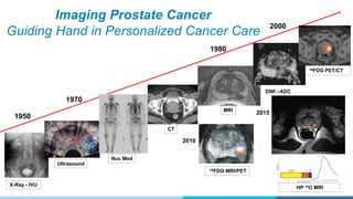 Imaging Prostate Cancer
Guiding Hand in Personalized Cancer Care
1950
1970
1980
2000
Ultrasound
X-Ray - IVU
CT
Nuc Med
MRI
18FDG MRI/PET
2015
2010
18FDG PET/CT
DWI –ADC
HP 13C MRI
 
