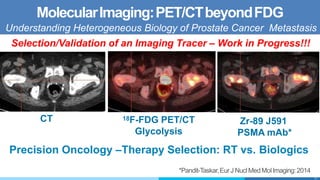 24
18F-FDG PET/CT
Glycolysis
CT
*Pandit-Taskar,EurJ NuclMedMolImaging:2014
Zr-89 J591
PSMA mAb*
Precision Oncology –Therapy Selection: RT vs. Biologics
MolecularImaging:PET/CTbeyondFDG
Understanding Heterogeneous Biology of Prostate Cancer Metastasis
Selection/Validation of an Imaging Tracer – Work in Progress!!!
 