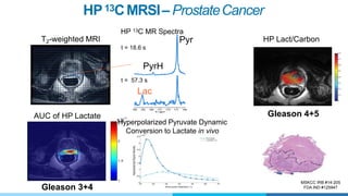 HP13CMRSI– ProstateCancer
MSKCC IRB #14-205
FDA IND #125947
Pyr
t = 18.6 s
PyrH
t = 57.3 s
Lac
T2-weighted MRI
HP 13C MR Spectra
AUC of HP Lactate
HP Lact/Carbon
Gleason 4+5
Gleason 3+4
Hyperpolarized Pyruvate Dynamic
Conversion to Lactate in vivo
 