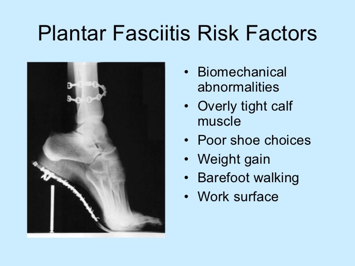 Heel pain from the American Podiatric Medical Association