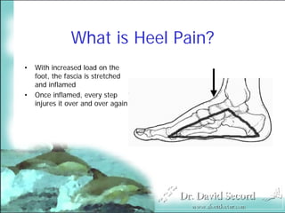 Heel Pain