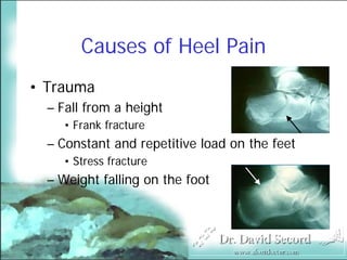 Heel Pain