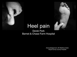 Heel pain
Derek Park
Barnet & Chase Farm Hospital
Acknowledgement: Mr Matthew Solan
Royal Surrey County Hospital
 