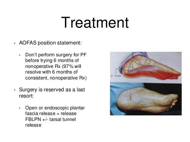heel injury treatment