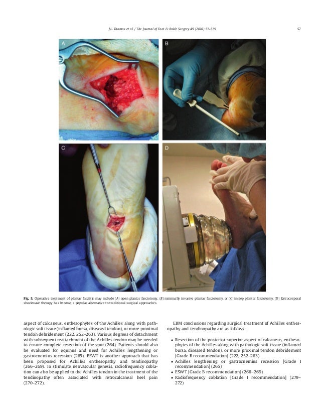 Heel Pain and Plantar Fasciitis