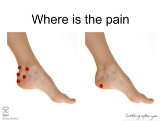 Where is the pain
 