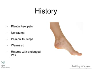 History
• Plantar heel pain
• No trauma
• Pain on 1st steps
• Warms up
• Returns with prolonged
WB
 