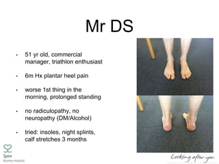 Mr DS
• 51 yr old, commercial
manager, triathlon enthusiast
• 6m Hx plantar heel pain
• worse 1st thing in the
morning, prolonged standing
• no radiculopathy, no
neuropathy (DM/Alcohol)
• tried: insoles, night splints,
calf stretches 3 months
 