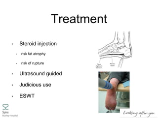 Treatment
• Steroid injection
• risk fat atrophy
• risk of rupture
• Ultrasound guided
• Judicious use
• ESWT
 