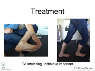 Treatment
TA stretching, technique important
 