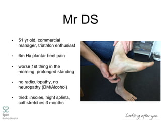 Mr DS
• 51 yr old, commercial
manager, triathlon enthusiast
• 6m Hx plantar heel pain
• worse 1st thing in the
morning, prolonged standing
• no radiculopathy, no
neuropathy (DM/Alcohol)
• tried: insoles, night splints,
calf stretches 3 months
 