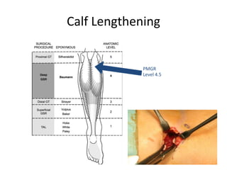 Calf Lengthening
PMGR
Level 4.5
 