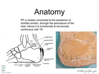 Anatomy
PF is closely connected to the paratenon of
Achilles tendon, through the periosteum of the
heel. Hence it is functionally & structurally
continuous with TA
 