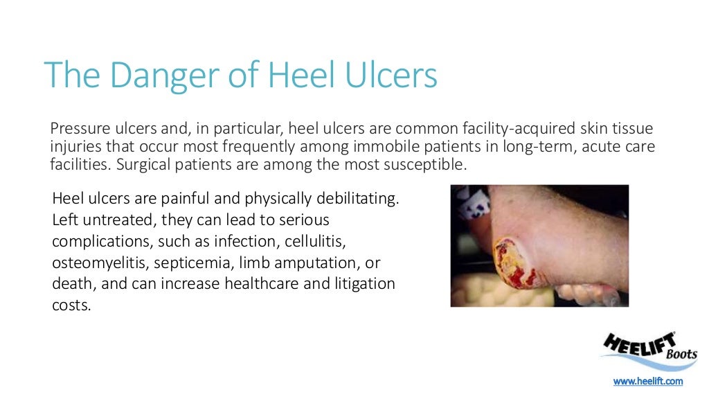 Heel Pressure Ulcer Prevention