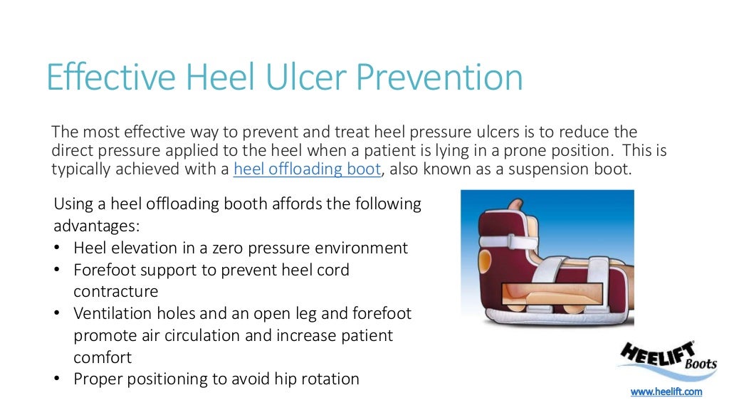 Heel Pressure Ulcer Prevention