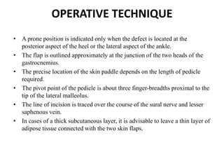 OPERATIVE TECHNIQUE
• A prone position is indicated only when the defect is located at the
posterior aspect of the heel or the lateral aspect of the ankle.
• The flap is outlined approximately at the junction of the two heads of the
gastrocnemius.
• The precise location of the skin paddle depends on the length of pedicle
required.
• The pivot point of the pedicle is about three finger-breadths proximal to the
tip of the lateral malleolus.
• The line of incision is traced over the course of the sural nerve and lesser
saphenous vein.
• In cases of a thick subcutaneous layer, it is advisable to leave a thin layer of
adipose tissue connected with the two skin flaps.
 