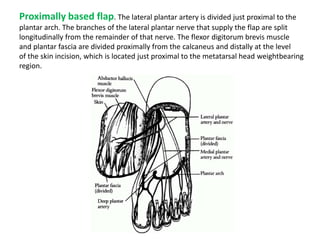Proximally based flap. The lateral plantar artery is divided just proximal to the
plantar arch. The branches of the lateral plantar nerve that supply the flap are split
longitudinally from the remainder of that nerve. The flexor digitorum brevis muscle
and plantar fascia are divided proximally from the calcaneus and distally at the level
of the skin incision, which is located just proximal to the metatarsal head weightbearing
region.
 