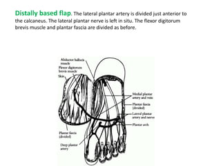 Distally based flap. The lateral plantar artery is divided just anterior to
the calcaneus. The lateral plantar nerve is left in situ. The flexor digitorum
brevis muscle and plantar fascia are divided as before.
 