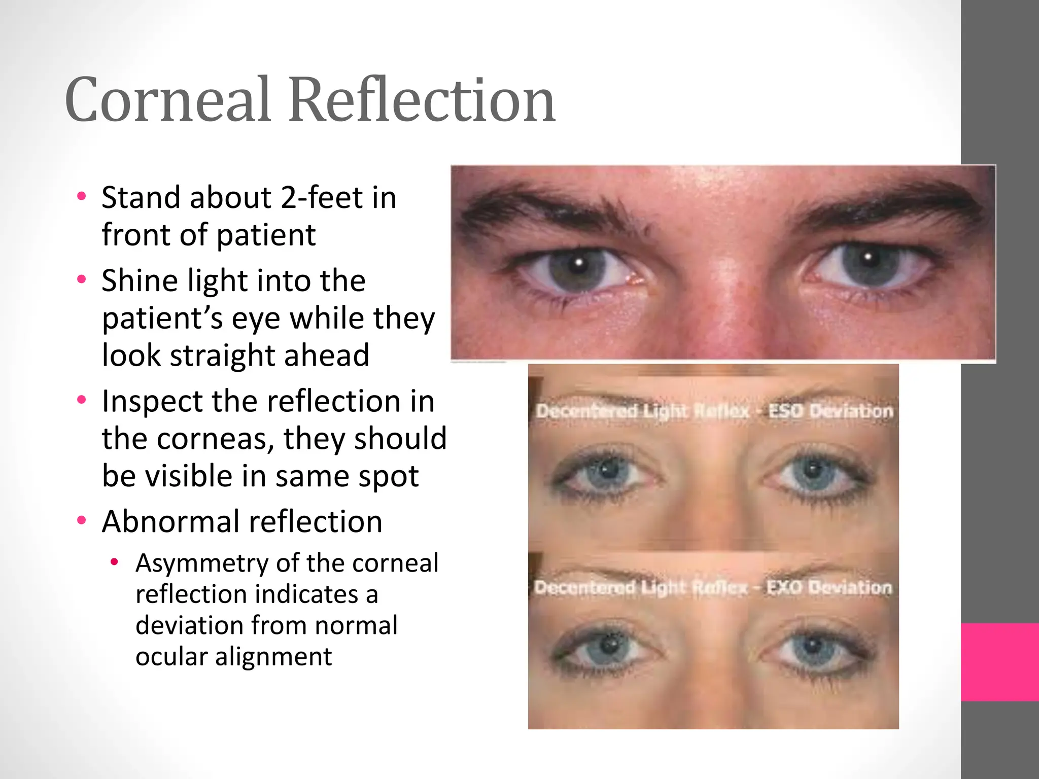 Corneal Reflection
• Stand about 2-feet in
front of patient
• Shine light into the
patient’s eye while they
look straight ahead
• Inspect the reflection in
the corneas, they should
be visible in same spot
• Abnormal reflection
• Asymmetry of the corneal
reflection indicates a
deviation from normal
ocular alignment
 