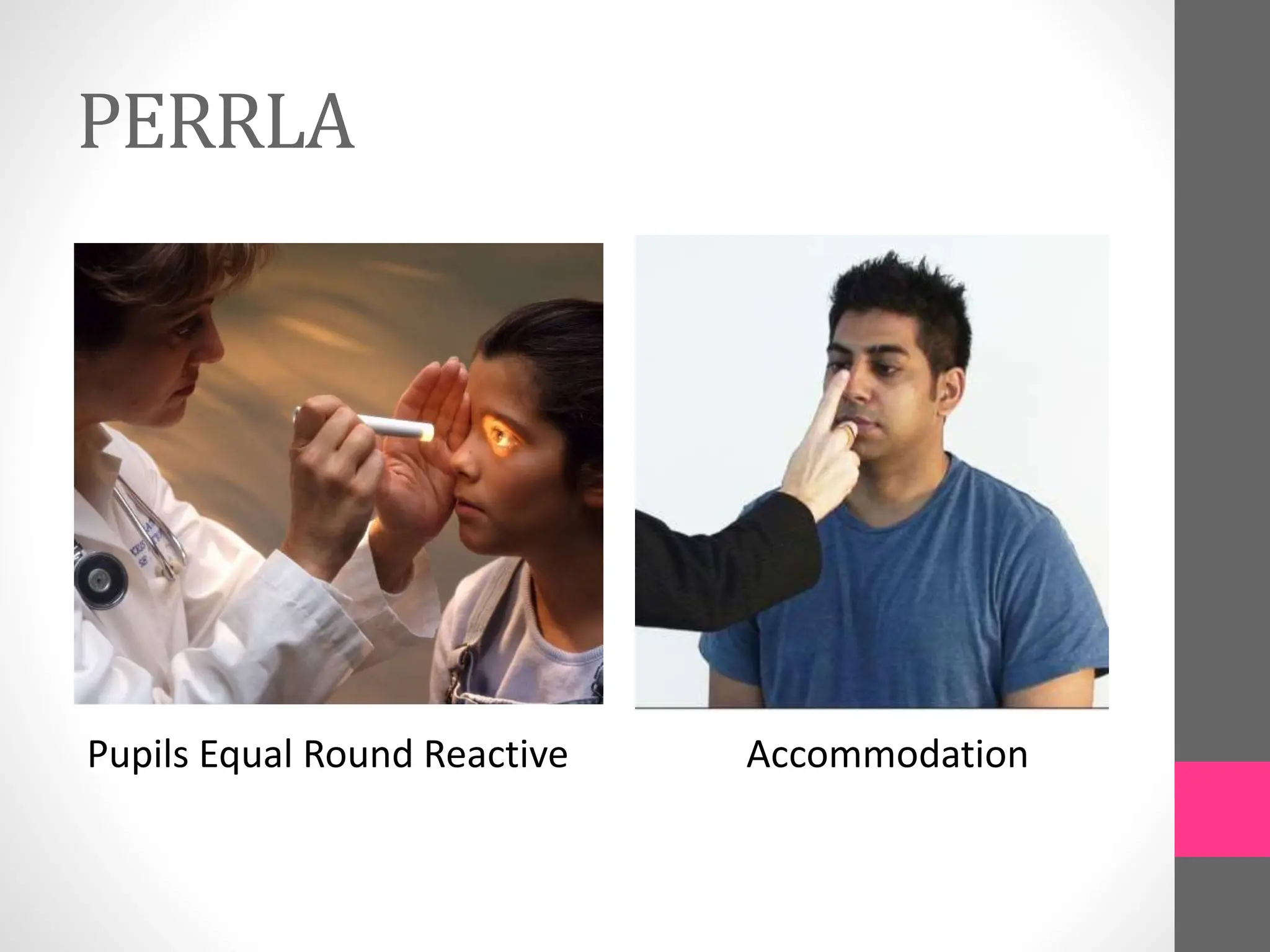 PERRLA
Accommodation
Pupils Equal Round Reactive
 