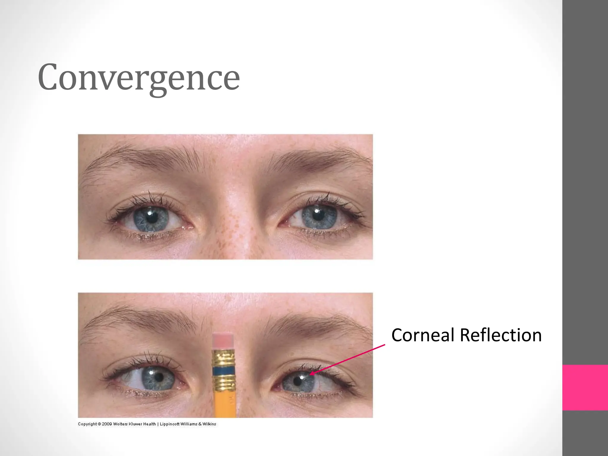Convergence
Corneal Reflection
 