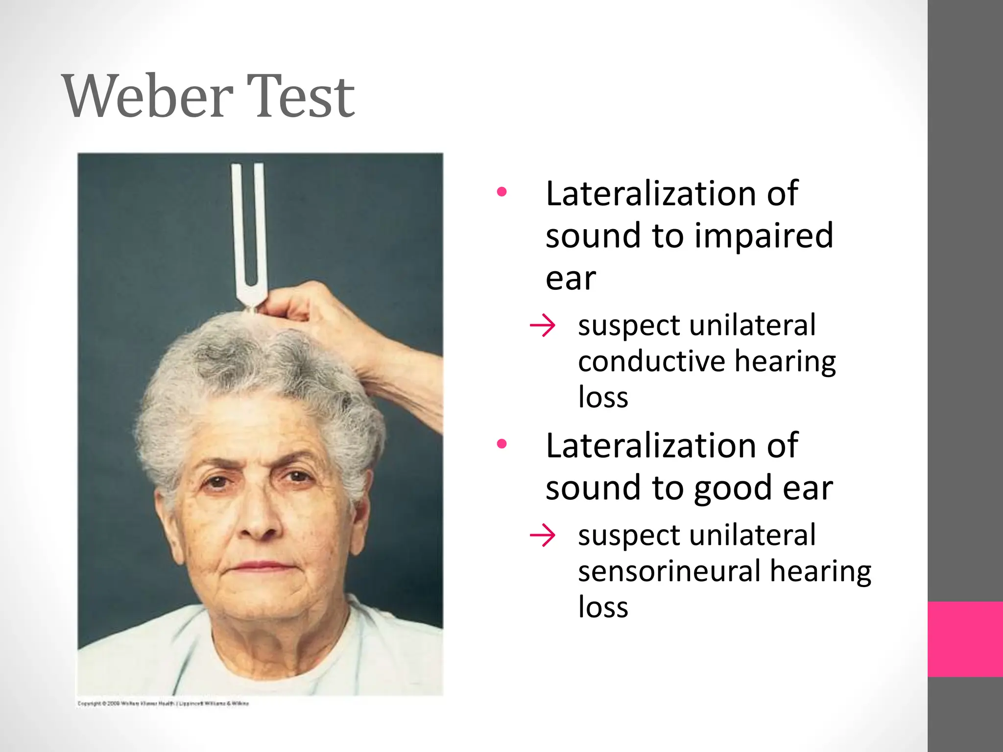 Weber Test
• Lateralization of
sound to impaired
ear
→ suspect unilateral
conductive hearing
loss
• Lateralization of
sound to good ear
→ suspect unilateral
sensorineural hearing
loss
 