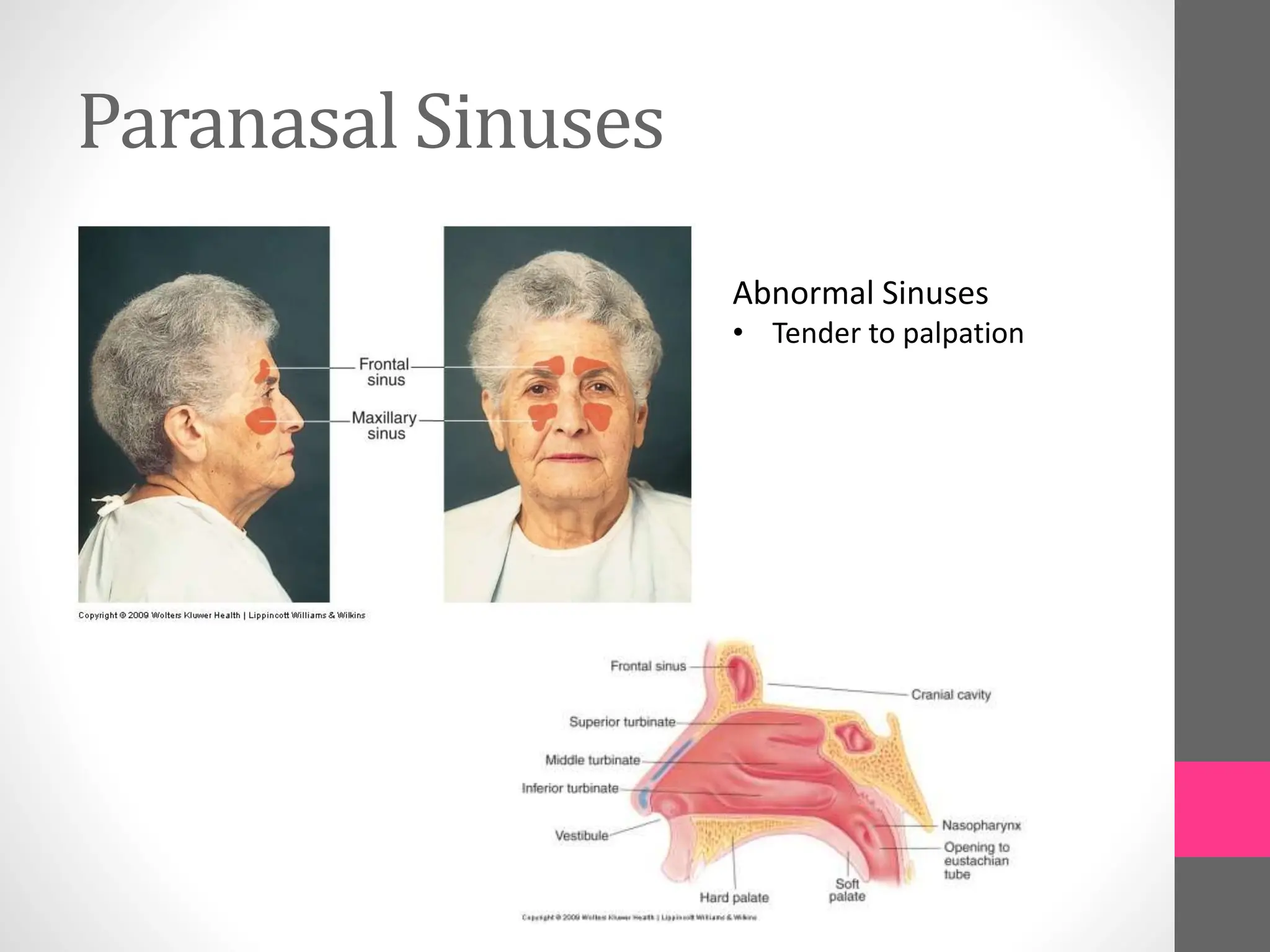 Paranasal Sinuses
Abnormal Sinuses
• Tender to palpation
 