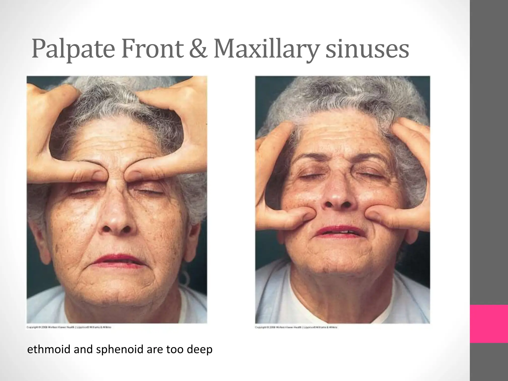 Palpate Front & Maxillary sinuses
ethmoid and sphenoid are too deep
 