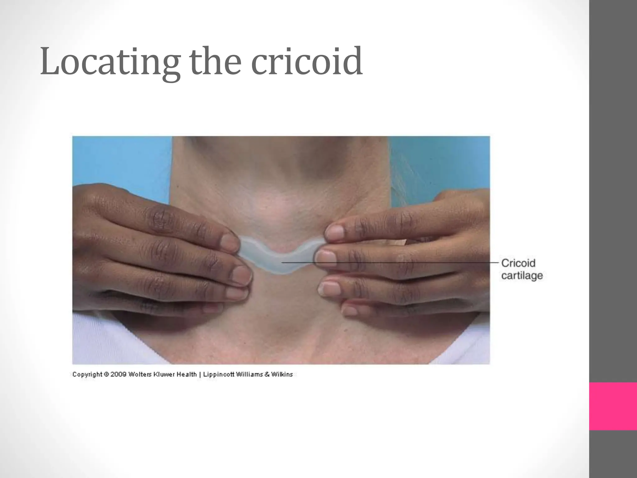 Locating the cricoid
 