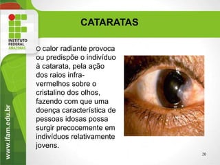 CATARATAS
20
O calor radiante provoca
ou predispõe o indivíduo
à catarata, pela ação
dos raios infra-
vermelhos sobre o
cristalino dos olhos,
fazendo com que uma
doença característica de
pessoas idosas possa
surgir precocemente em
indivíduos relativamente
jovens.
 
