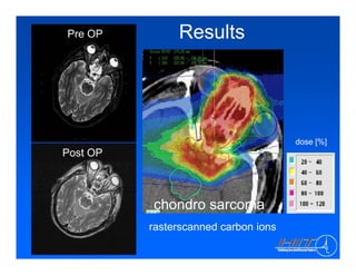 Heidelberg Ion Therapy Center