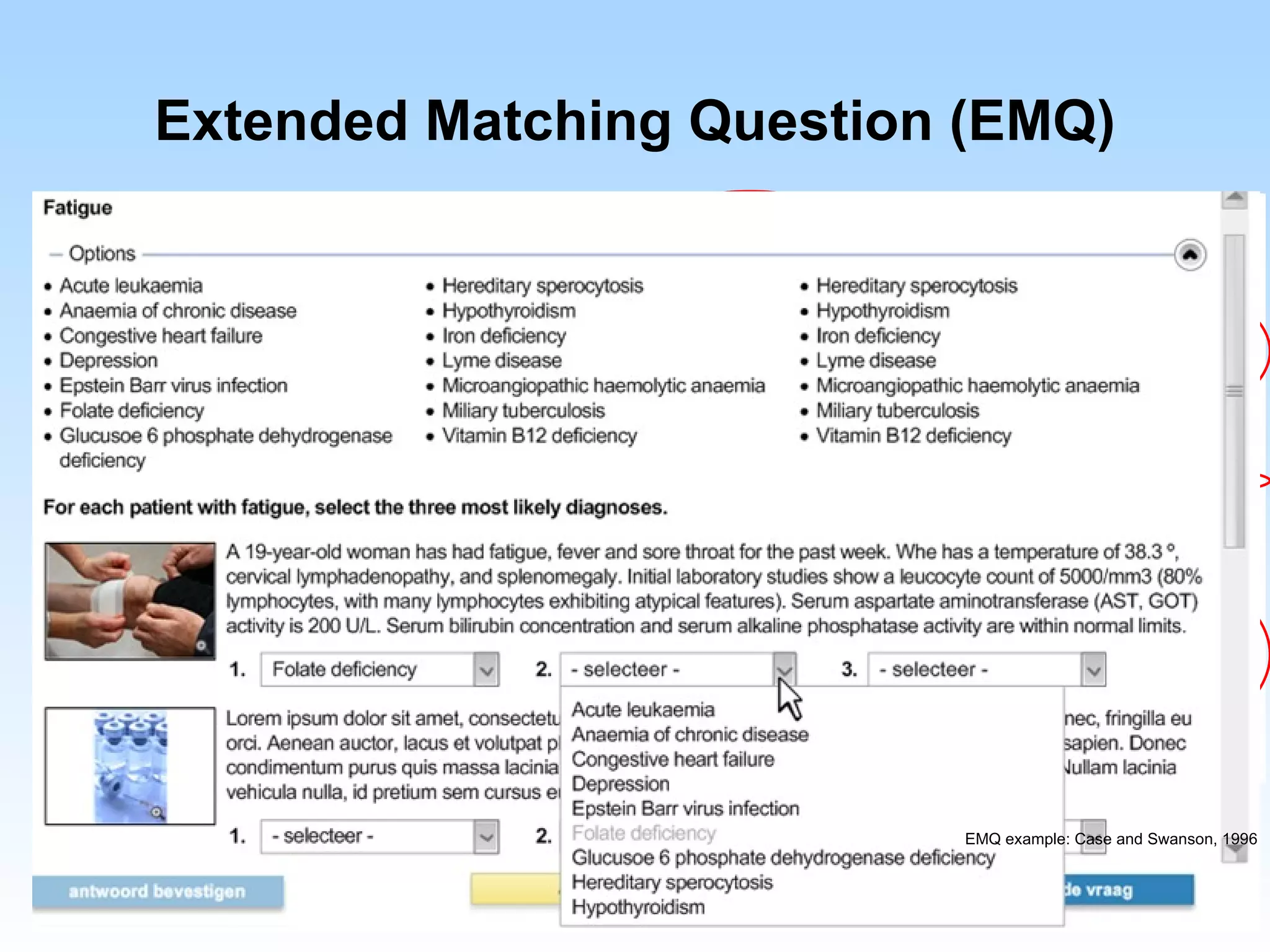 Extended Matching Question (EMQ)

• Starting with a theme
  or clinical problem

• A list with 8-15 options

• Question

• 2 or 3 patient vignettes

• Scoring: points for each
  correct answer; multiple
  answers may be correct
                              EMQ example: Case and Swanson, 1996
 