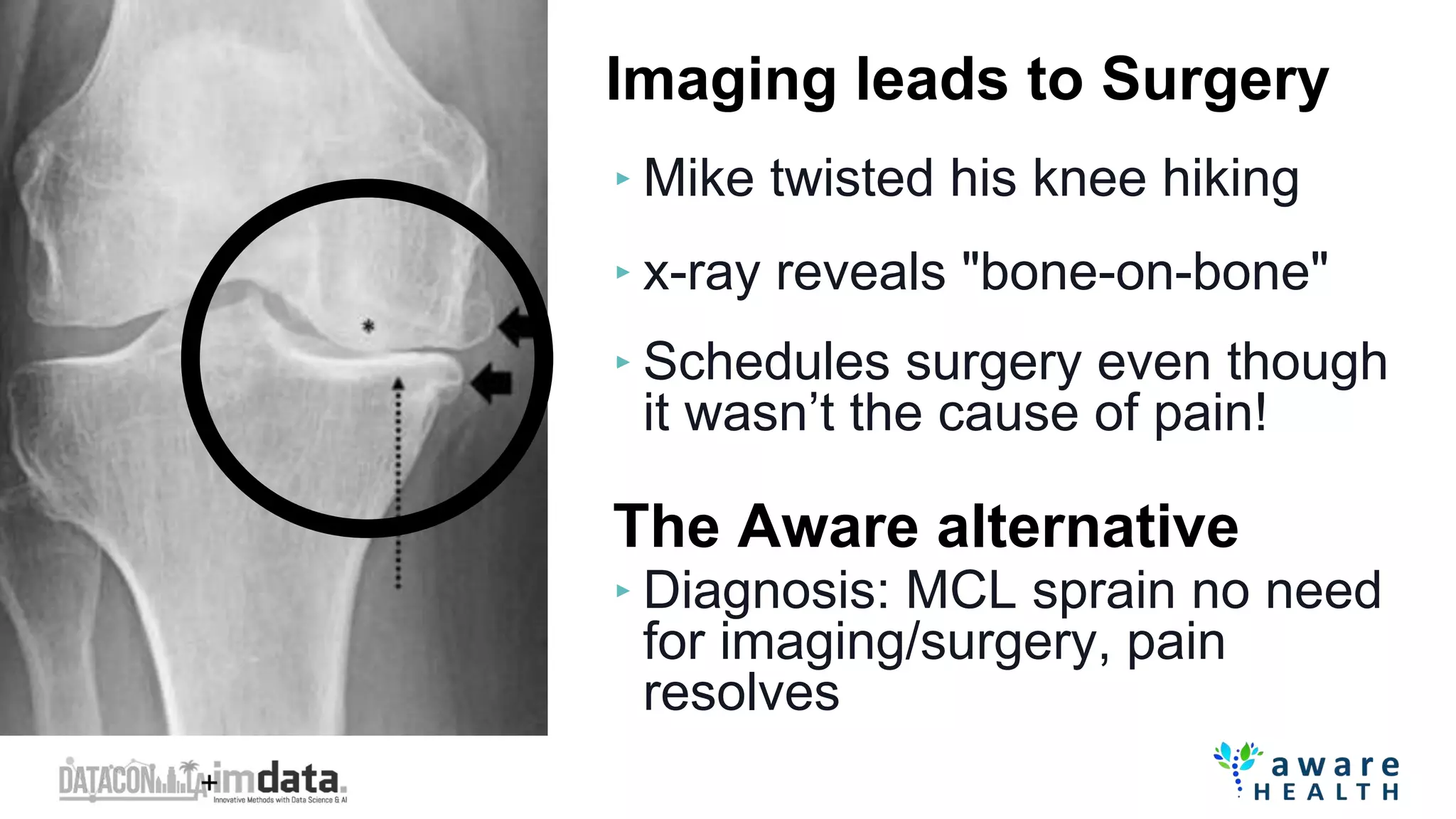 Imaging leads to Surgery
‣ Mike twisted his knee hiking
‣ x-ray reveals "bone-on-bone"
‣ Schedules surgery even though
it wasn’t the cause of pain!
The Aware alternative
‣ Diagnosis: MCL sprain no need
for imaging/surgery, pain
resolves
 