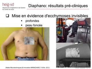 Diaphano: résultats pré-cliniques
                             /////////////////////////////////////////////////////////////////////////////////////////////////////////////////////////////////////////////////



 Mise en évidence d'ecchymoses invisibles
                          profondes
                          peau foncée




Atelier Microtechniques & Innovation MINNOVARC 7-8 fév. 2013                                                                                 Didier Maillefer p.13
 
