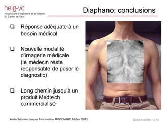 Diaphano: conclusions
                             /////////////////////////////////////////////////////////////////////////////////////////////////////////////////////////////////////////////////



       Réponse adéquate à un
        besoin médical

       Nouvelle modalité
        d'imagerie médicale
        (le médecin reste
        responsable de poser le
        diagnostic)

       Long chemin jusqu'à un
        produit Medtech
        commercialisé

Atelier Microtechniques & Innovation MINNOVARC 7-8 fév. 2013                                                                                 Didier Maillefer p.16
 