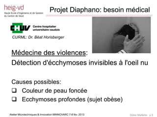 Projet Diaphano: besoin médical
                             /////////////////////////////////////////////////////////////////////////////////////////////////////////////////////////////////////////////////




 CURML: Dr. Béat Horisberger



 Médecine des violences:
 Détection d'écchymoses invisibles à l'oeil nu

 Causes possibles:
  Couleur de peau foncée
  Ecchymoses profondes (sujet obèse)

Atelier Microtechniques & Innovation MINNOVARC 7-8 fév. 2013                                                                                   Didier Maillefer p.5
 