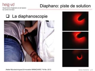 Diaphano: piste de solution
                             /////////////////////////////////////////////////////////////////////////////////////////////////////////////////////////////////////////////////



 La diaphanoscopie




Atelier Microtechniques & Innovation MINNOVARC 7-8 fév. 2013                                                                                   Didier Maillefer p.6
 