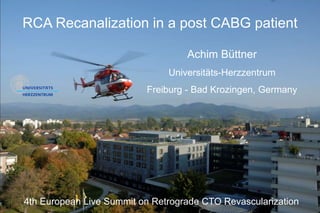 RCA Recanalization in a post CABG patient
Achim Büttner
Universitäts-Herzzentrum
Freiburg - Bad Krozingen, Germany
4th European Live Summit on Retrograde CTO Revascularization
 