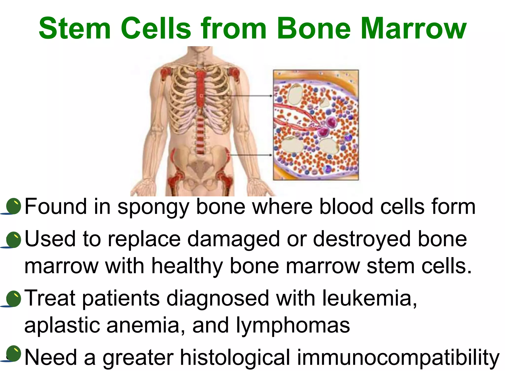 Stem Cells from Bone Marrow
• Found in spongy bone where blood cells form
• Used to replace damaged or destroyed bone
marrow with healthy bone marrow stem cells.
• Treat patients diagnosed with leukemia,
aplastic anemia, and lymphomas
• Need a greater histological immunocompatibility
 