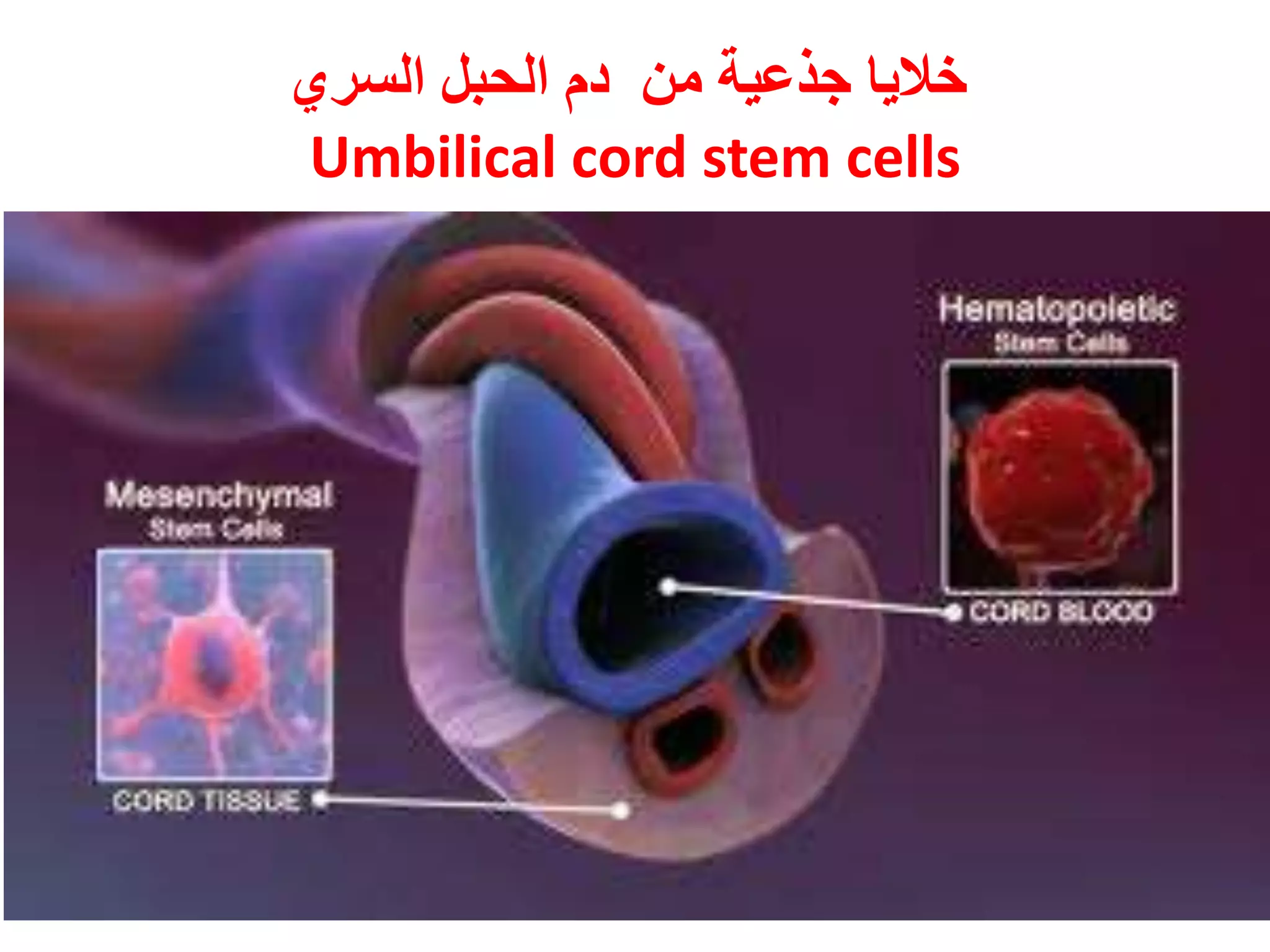 ‫من‬ ‫جذعية‬ ‫خاليا‬‫السري‬ ‫الحبل‬ ‫دم‬
Umbilical cord stem cells
 