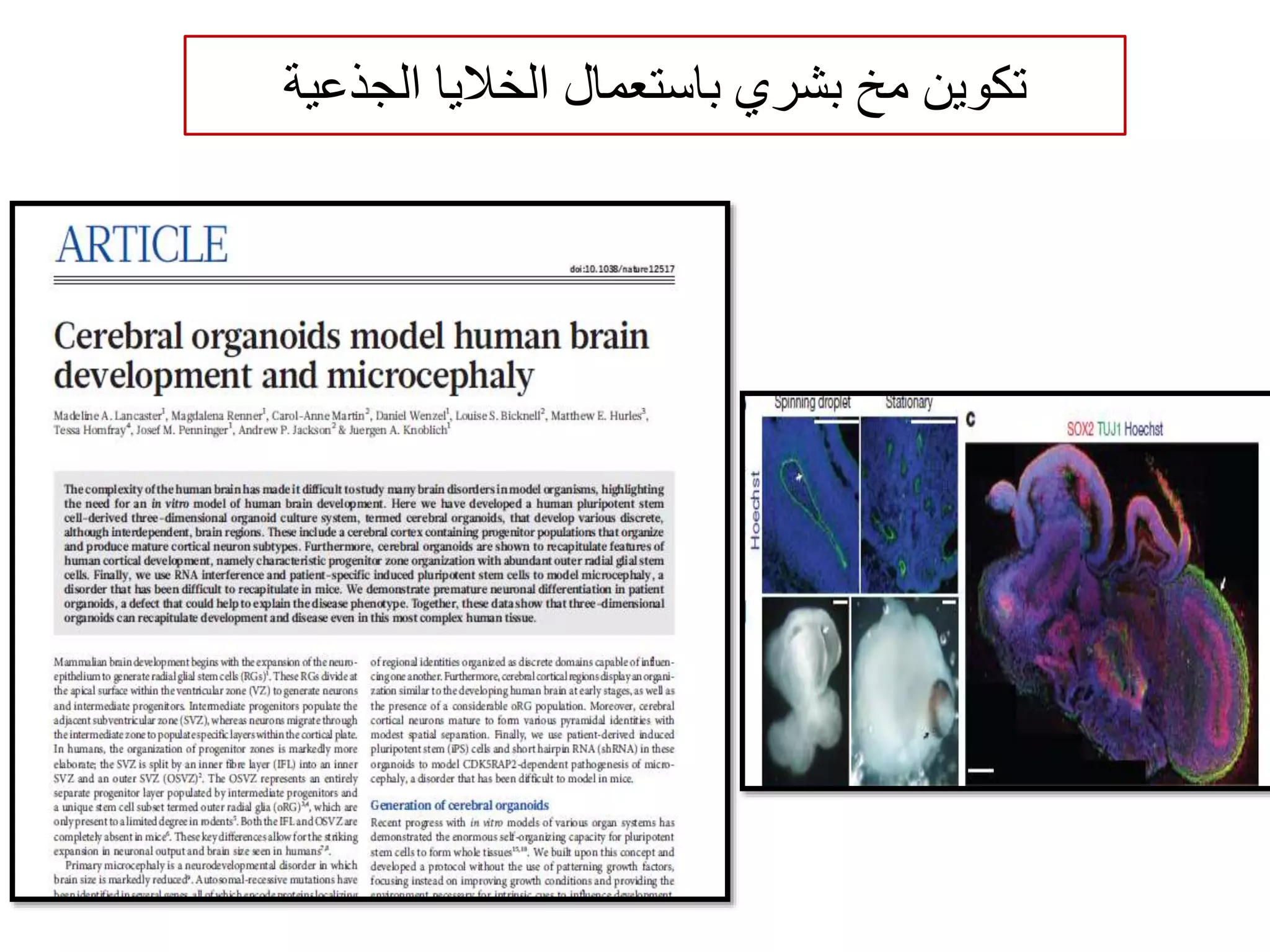 ‫تكوين‬‫مخ‬‫بشري‬‫الجذعية‬ ‫الخاليا‬ ‫باستعمال‬
 